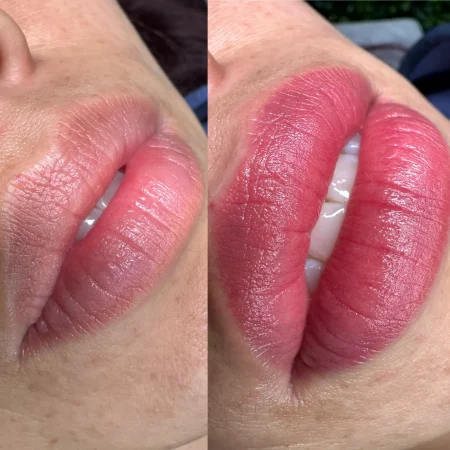 cosmetic lip tattooing melbourne
