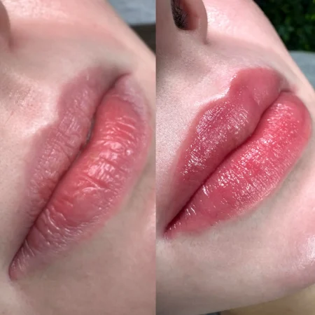 cosmetic tattoo