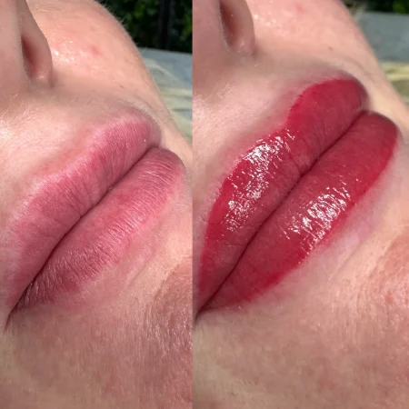 cosmetic tattooing