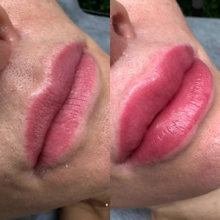 lip blush