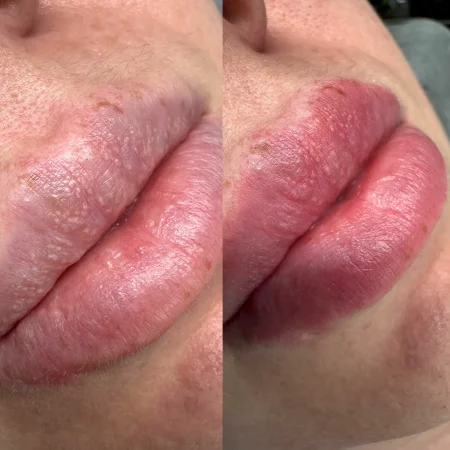 lip tattooing melbourne