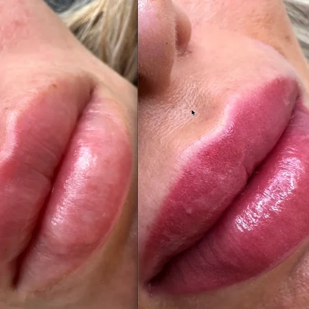 microblading lips