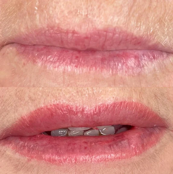 lip liner before and after