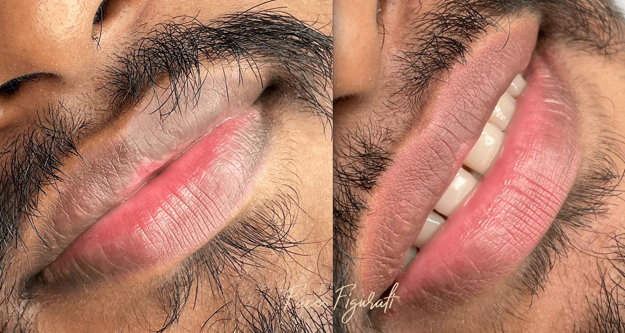 Lip Neutralisation tattoo