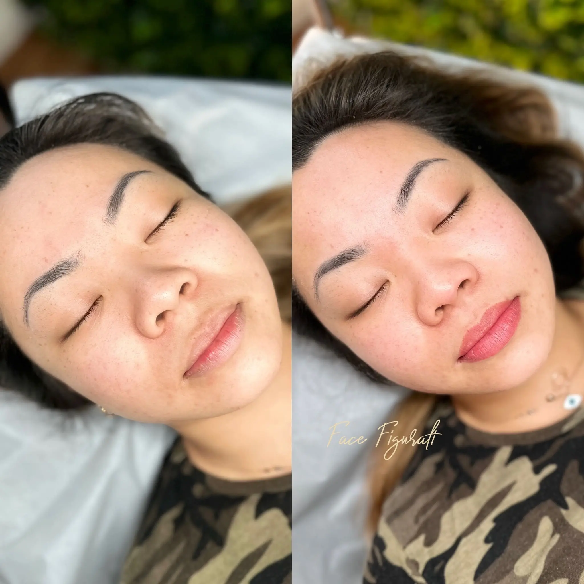 Melbourne Dark lip Neutralization