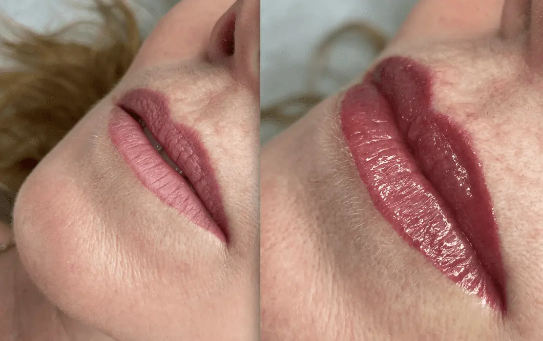 aquarelle lips before and after