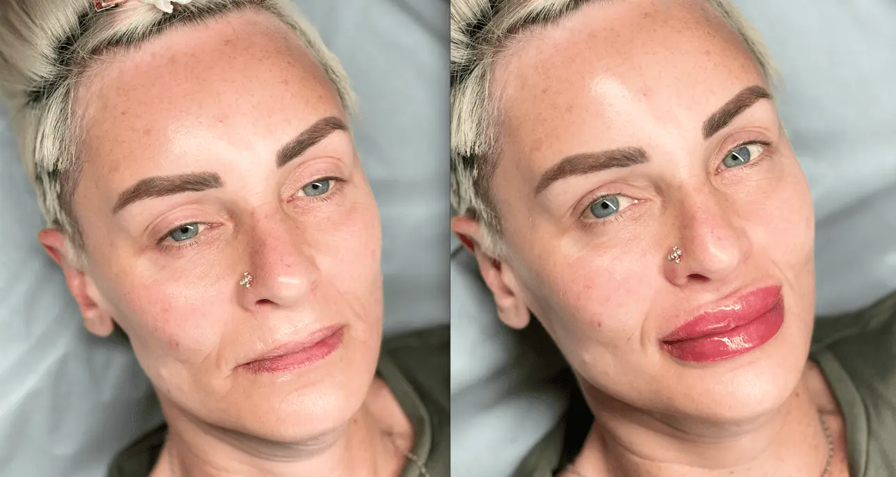 aquarelle lips healing