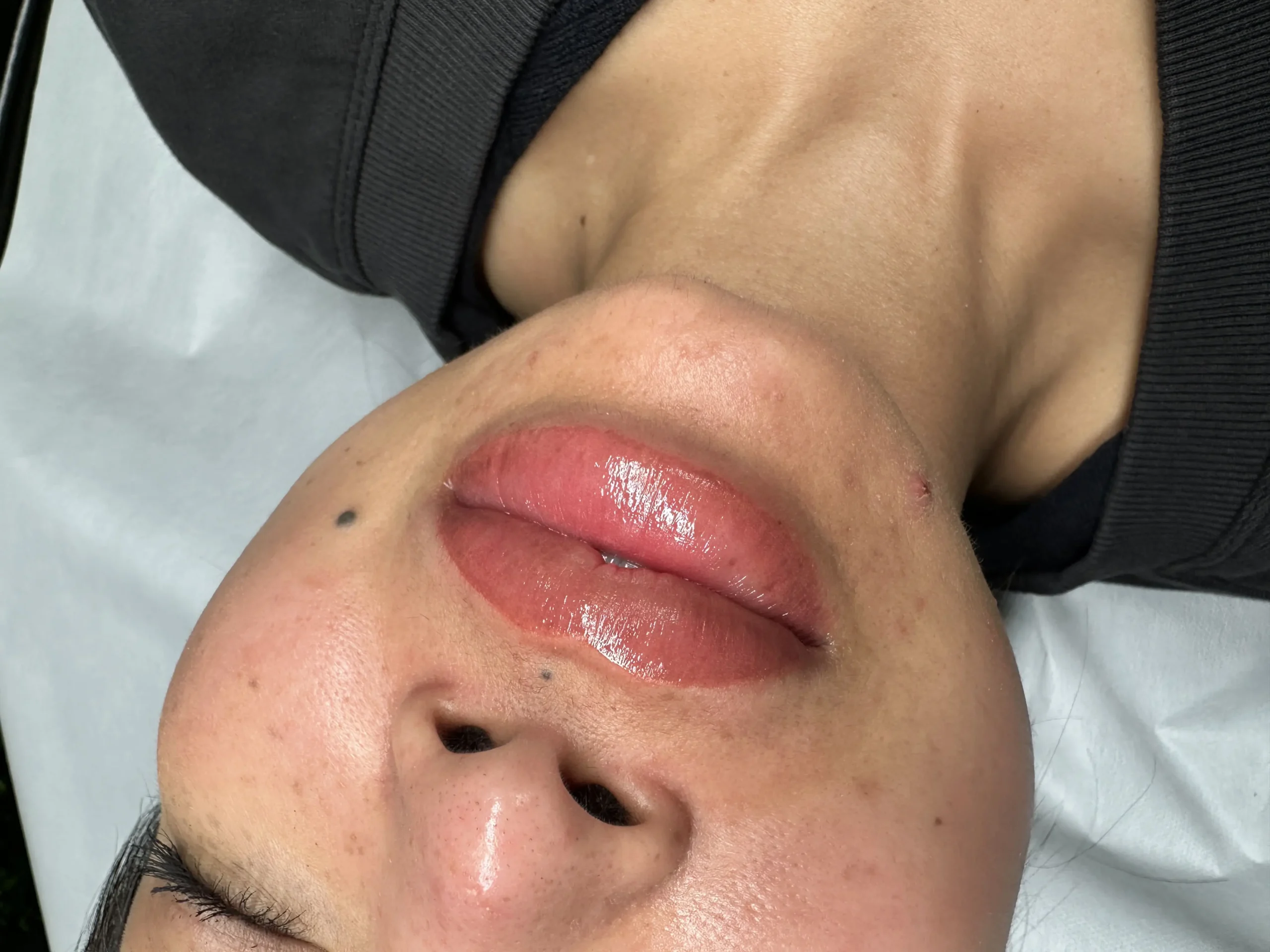 dark lip neutralisation