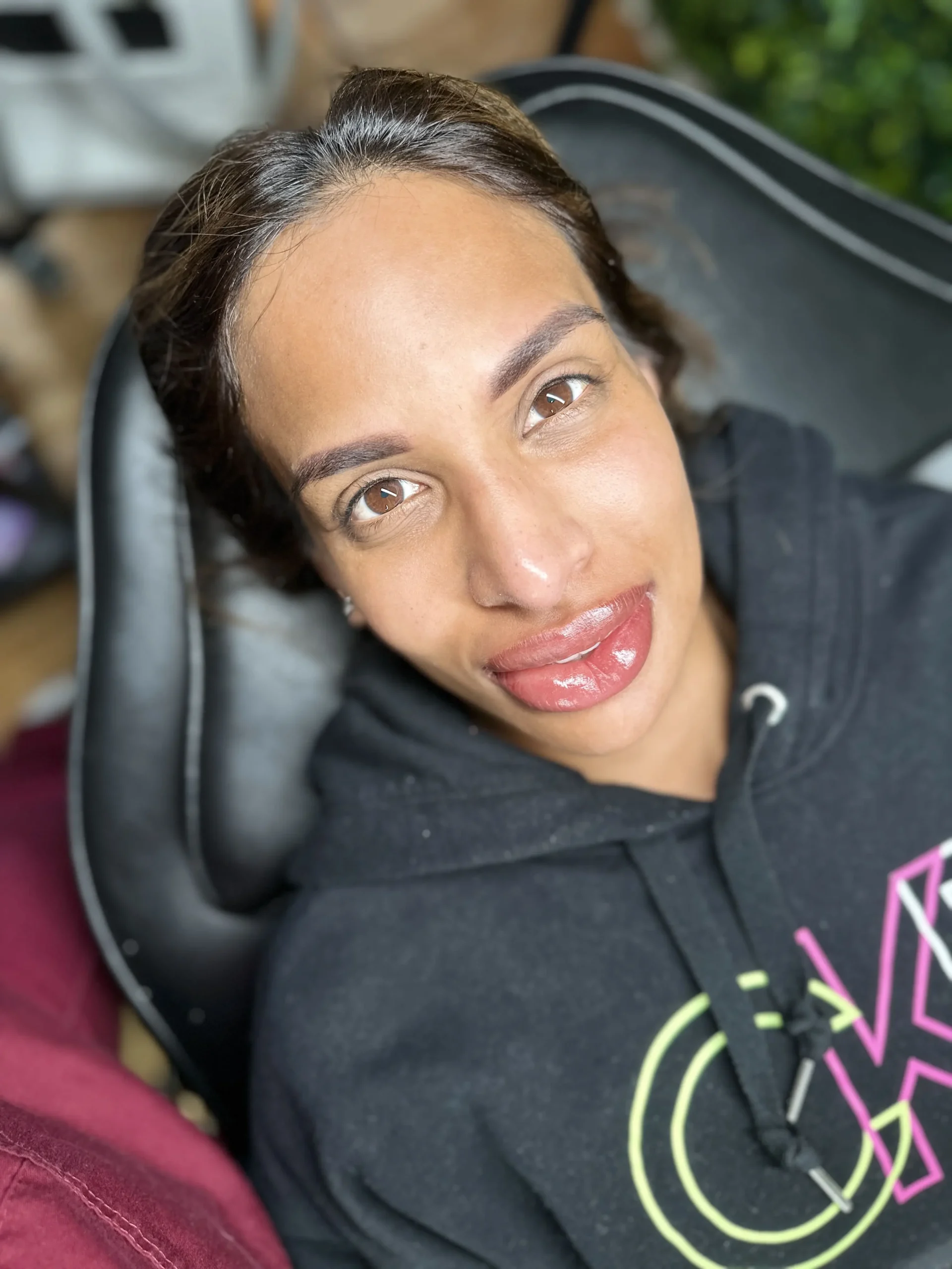 dark lip neutralisation tooting