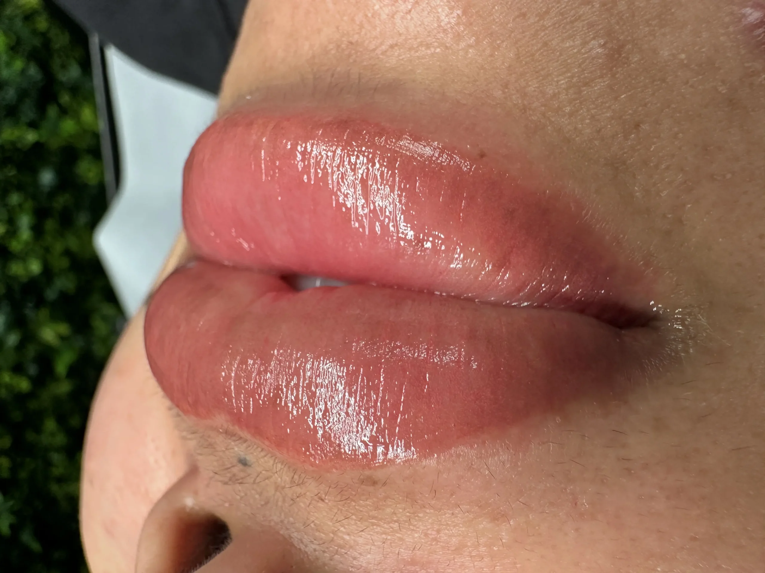 dark lips neutralisation