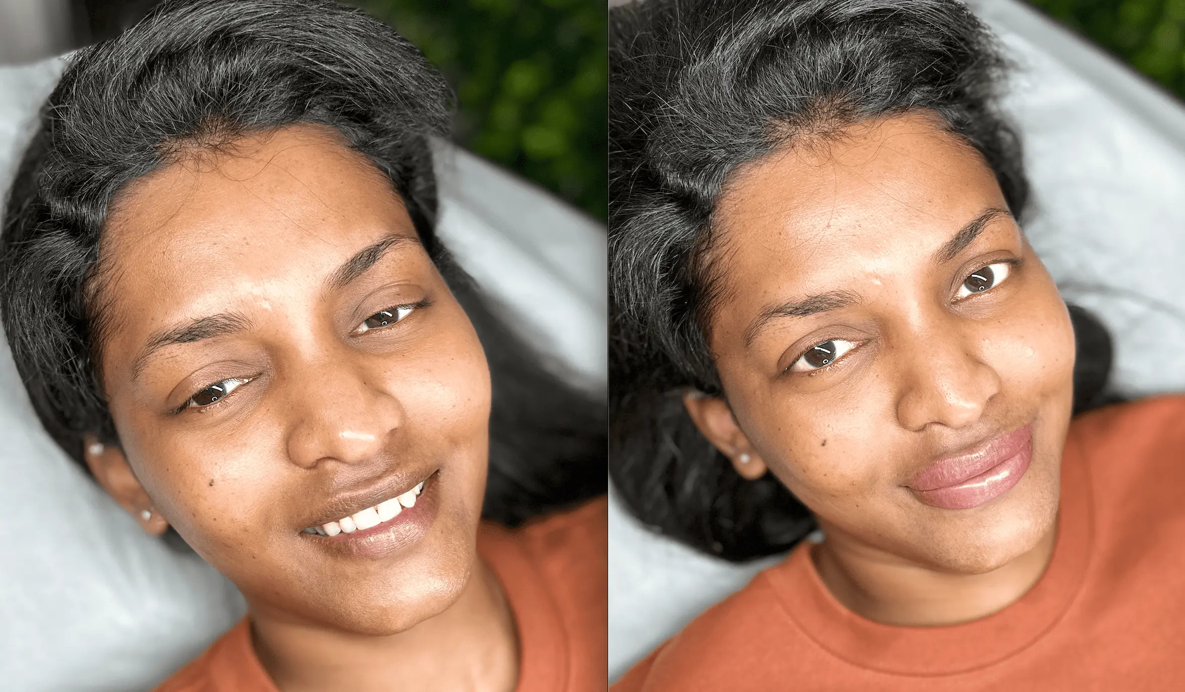 lip neutralization healing process