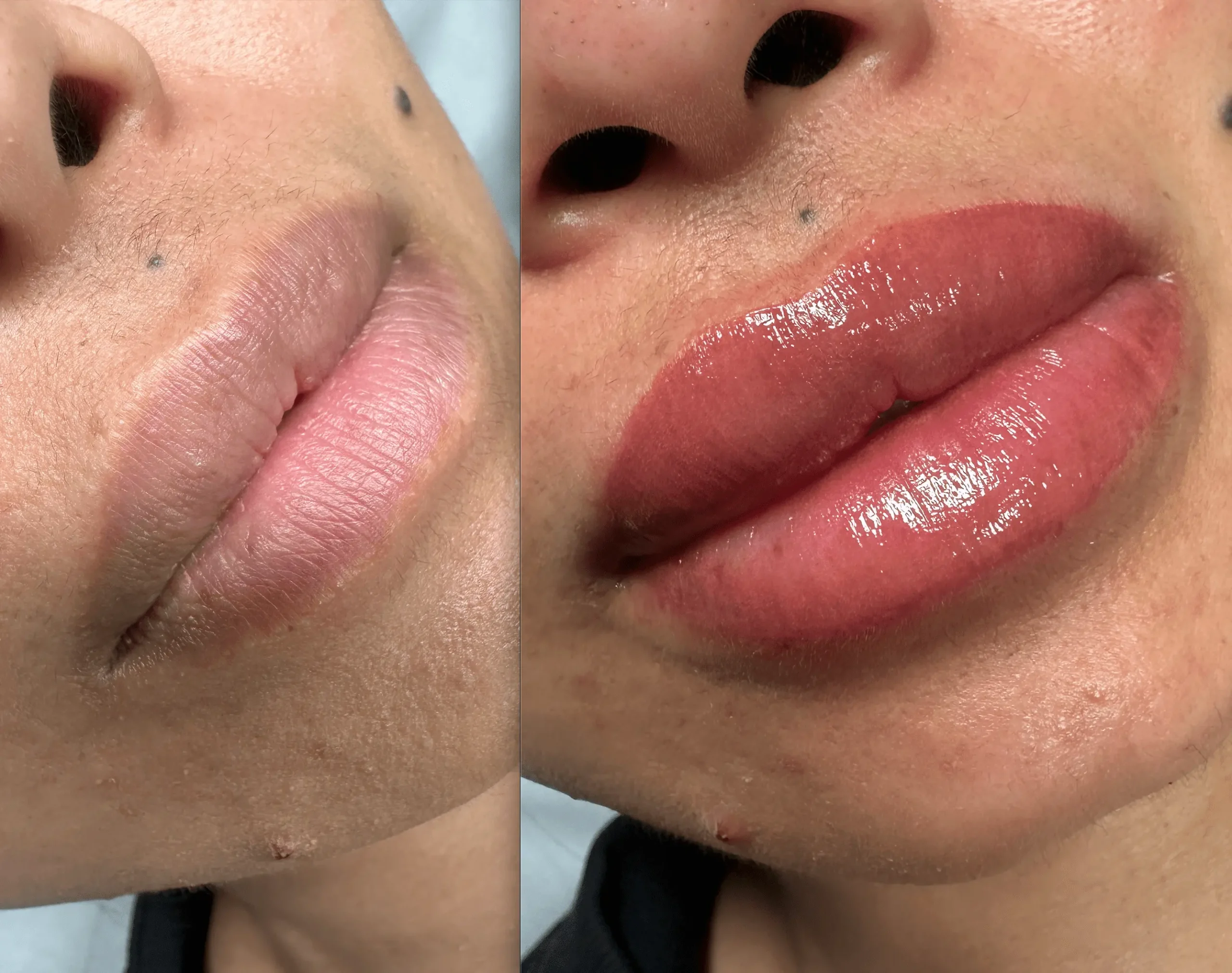 lip neutralization tattoo