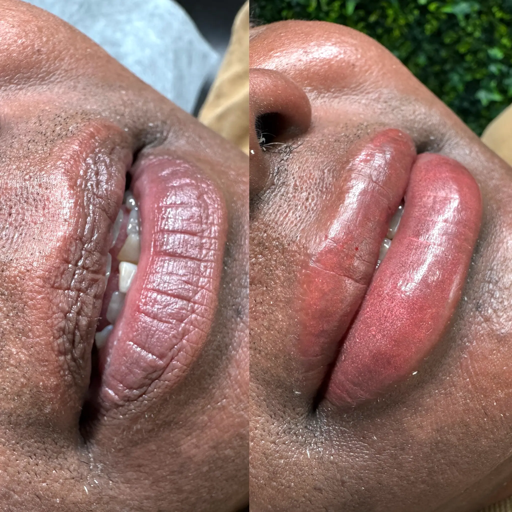 cosmetic lip tattoo melbourne