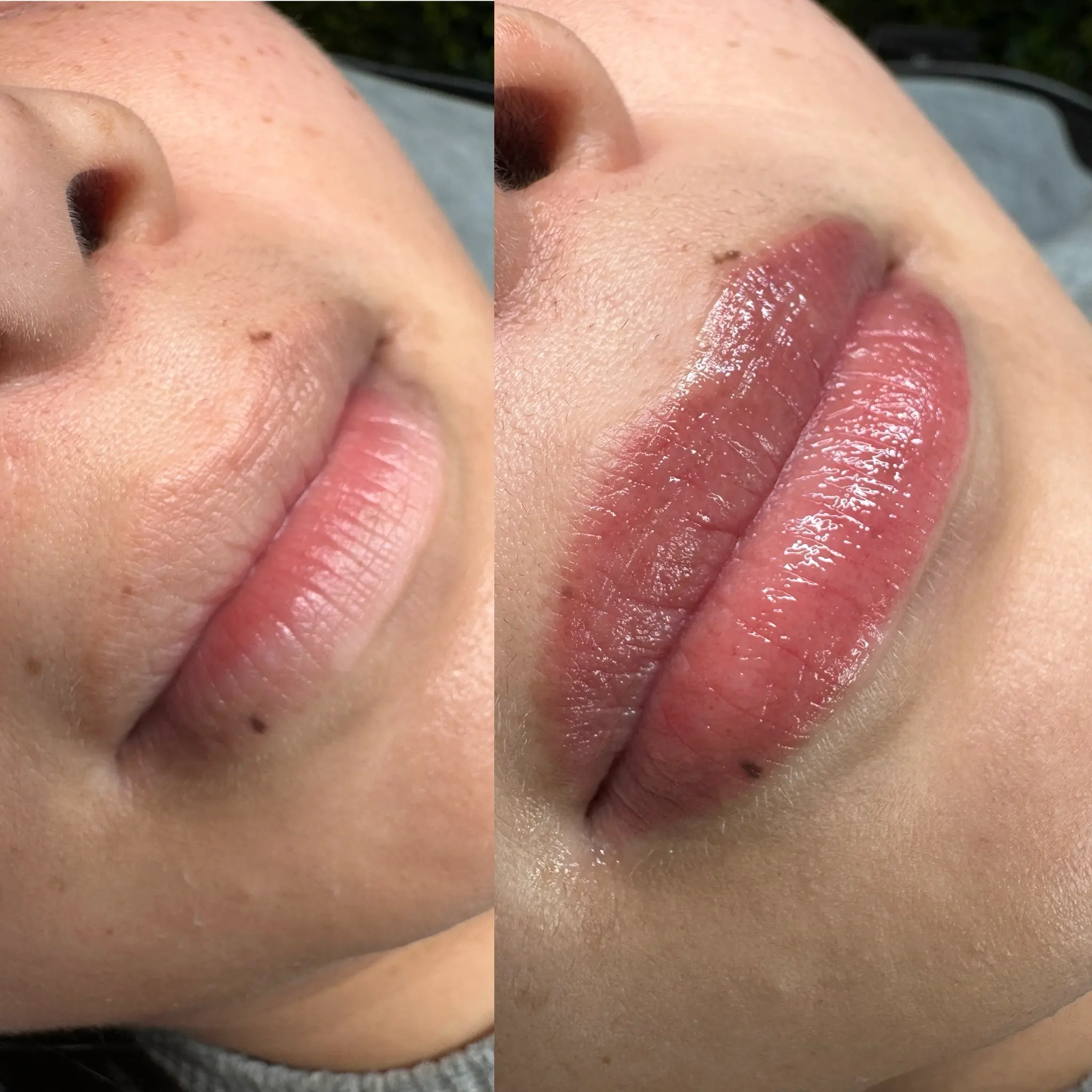 cosmetic tattooing lips