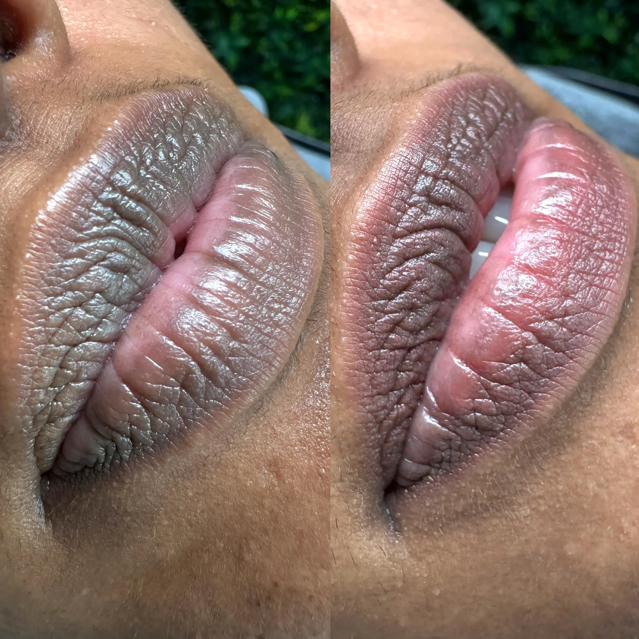 lip blush treatment
