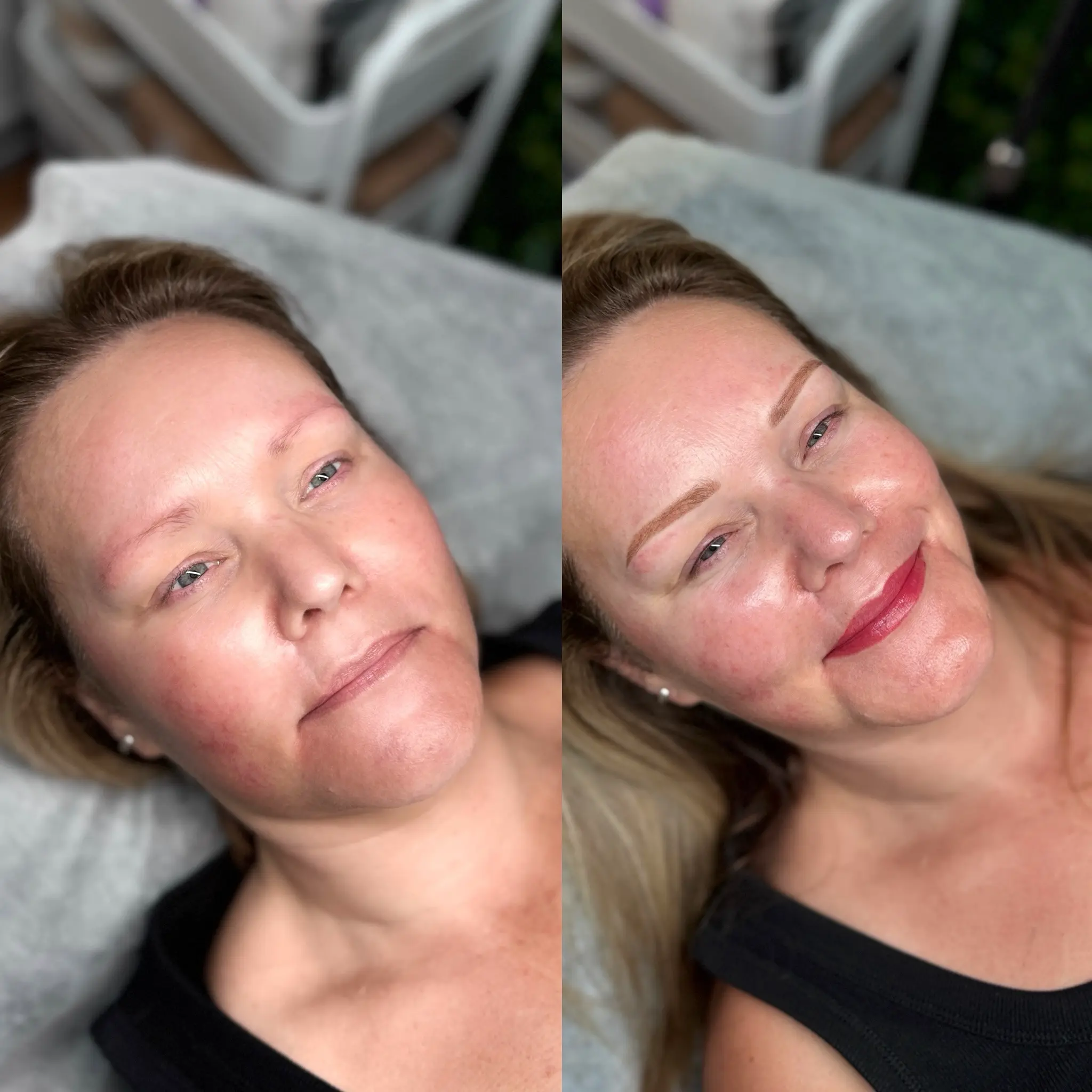 lip tattoo treatment