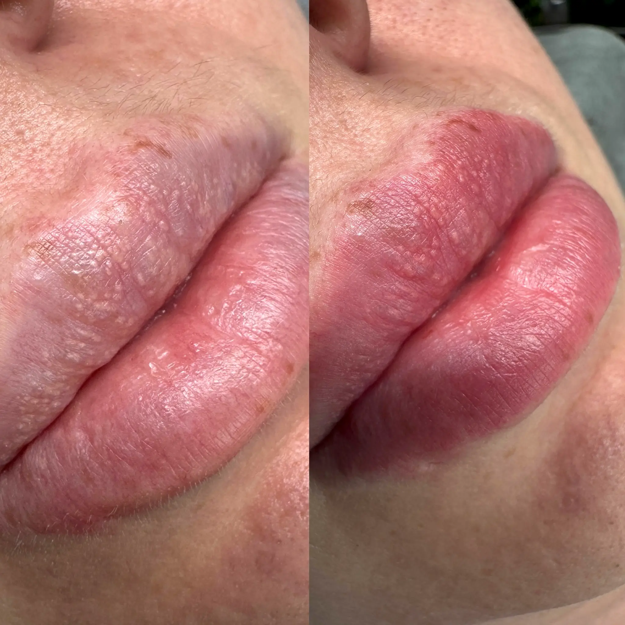 lip tattooing melbourne