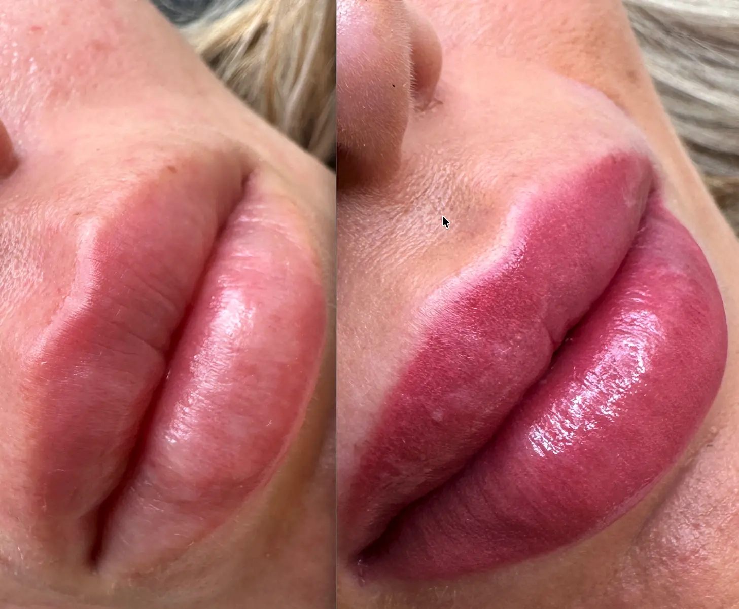 microblading lips